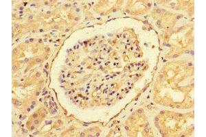 Immunohistochemistry of paraffin-embedded human kidney tissue using ABIN7151461 at dilution of 1:100 (EHD3 antibody  (AA 269-498))