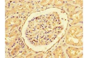 Immunohistochemistry of paraffin-embedded human kidney tissue using ABIN7151461 at dilution of 1:100 (EHD3 antibody  (AA 269-498))