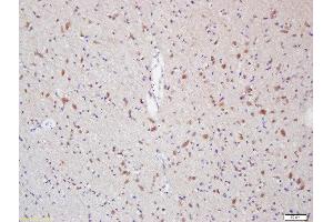 Formalin-fixed and paraffin embedded rat brain labeled with Anti-Myelin Protein Zero Polyclonal Antibody, Unconjugated  at 1:200 followed by conjugation to the secondary antibody and DAB staining (MPZ antibody  (AA 175-248))