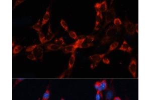 Immunofluorescence analysis of NIH/3T3 cells using CTSL Polyclonal Antibody at dilution of 1:100. (Cathepsin L antibody)
