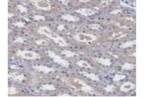Detection of UBE2L3 in Human Kidney Tissue using Polyclonal Antibody to Ubiquitin Conjugating Enzyme E2L3 (UBE2L3)