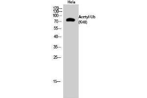 Western Blotting (WB) image for anti-Ubiquitin (Ubiquitin) (acLys48) antibody (ABIN3181499) (Ubiquitin antibody  (acLys48))
