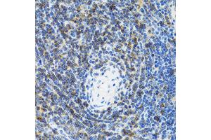 Immunohistochemistry of paraffin-embedded rat spleen using SRP19 antibody (ABIN2560139) at dilution of 1:100 (40x lens). (SRP19 antibody)