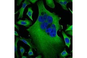 Immunofluorescent analysis of Beta-tubulin staining in Hela cells. (TUBB antibody)