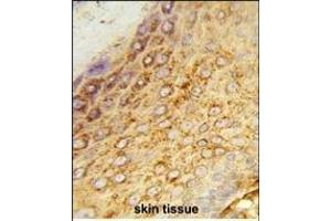 Formalin-fixed and paraffin-embedded human skin tissue reacted with LDHA Antibody (Center), which was peroxidase-conjugated to the secondary antibody, followed by DAB staining. (Lactate Dehydrogenase A antibody  (AA 154-182))