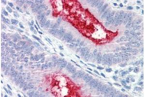 Anti-ENPP3 antibody  ABIN1048561 IHC staining of human uterus. (ENPP3 antibody  (Internal Region))