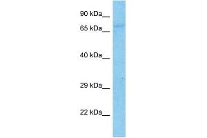 Host:  Rabbit  Target Name:  ZBTB3  Sample Type:  COLO205 Whole Cell lysates  Antibody Dilution:  1.