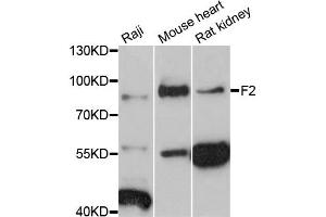 Western blot analysis of extracts of various cell lines, using F2 antibody (ABIN5997712) at 1:3000 dilution. (Prothrombin antibody)