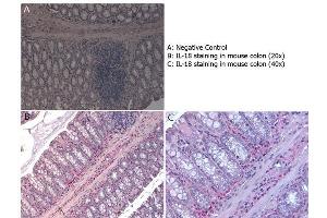 Immunohistochemistry with anti-IL-18 antibody showing IL-18 staining in inflammatory cells of the mucous corium of mouse colon at 20x and 40x (B & C). (IL-18 antibody  (AA 1-157))