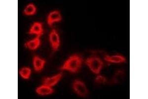 Immunofluorescent analysis of Cytochrome P450 51A1 staining in MCF7 cells. (CYP51A1 antibody)