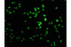 Immunofluorescence staining of HepG2 cells with ABIN7139585 at 1:2. (Histone H1-Like (LOC107807853) (meLys101) antibody)