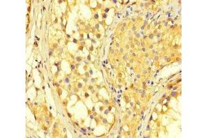 Immunohistochemistry of paraffin-embedded human testis tissue using ABIN7150987 at dilution of 1:100 (RNF2 antibody  (AA 1-100))