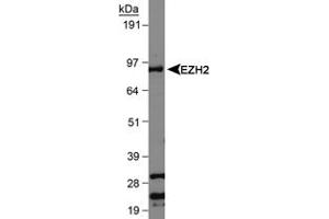 Western blot analysis of EZH2 in Jurkat whole cell lysate using EZH2 polyclonal antibody . (EZH2 antibody  (AA 300-400))