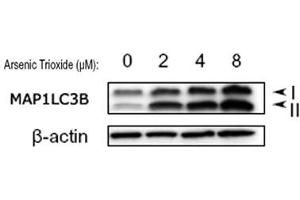 Western blot analysis of MAP1LC3B in treated U87 MG (human glioblastoma astrocytoma) lysates using MAP1LC3B polyclonal antibody .