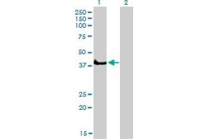 Western Blot analysis of SGK2 expression in transfected 293T cell line by SGK2 monoclonal antibody (M04A), clone 4B12. (SGK2 antibody  (AA 293-367))