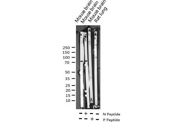 LIMK2 antibody  (pSer283)