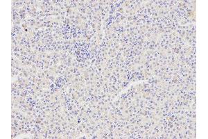 Immunohistochemistry of paraffin-embedded mouse kidney using FAS antibody at dilution of 1:400 (200x lens). (FAS antibody)