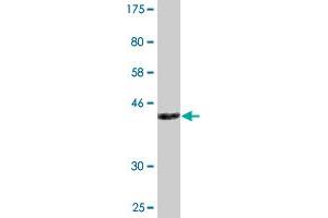 Western Blot detection against Immunogen (33 KDa) . (ATCAY antibody  (AA 3-68))