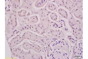 Formalin-fixed and paraffin embedded rat kidney tissue labeled with Anti-Phospho-Estrogen Receptor alpha (Ser118) Polyclonal Antibody, Unconjugated (ABIN684568) at 1:200 followed by conjugation to the secondary antibody and DAB staining (Estrogen Receptor alpha antibody  (pSer118))