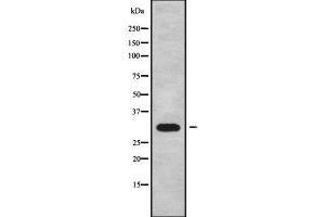 Western blot analysis of CABP4 using Jurkat whole cell lysates (CABP4 antibody  (Internal Region))