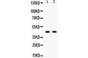 Observed bind size: 45KD (AIM2 antibody  (AA 14-215))