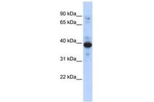 Image no. 1 for anti-Ring Finger Protein 34 (RNF34) (AA 143-192) antibody (ABIN6742950) (RNF34 antibody  (AA 143-192))