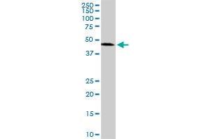 ADPRH monoclonal antibody (M04), clone 1F11. (ADPRH antibody  (AA 23-121))