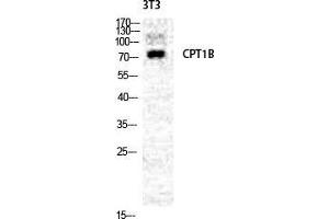 Western Blot (WB) analysis of NIH-3T3 cells using CPTI-M Polyclonal Antibody. (CPT1B antibody  (Internal Region))