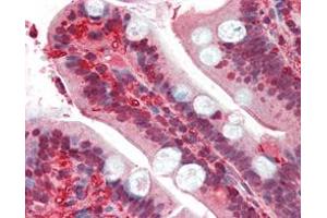 Immunohistochemical analysis of paraffin-embedded human small intestine tissues uing RSK1 mouse mAb. (RPS6KA1 antibody)