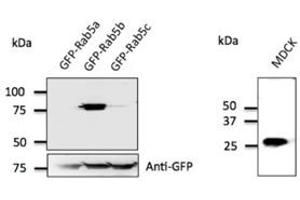 Anti-Rab5b Ab at 1/500 dilution; 293 cells transfected with GFP-Rab5; Iysates at 50 µg per Iane; rabbit polyclonal to goat IgG (HRP) at 1/10,000 dilution;