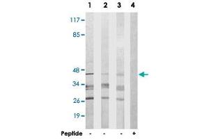 Western blot analysis of extracts from 293 cells (Lane 1), HepG2 cells (Lane 2) and COLO 205 cells (Lane 3 and 4), using GSC2 polyclonal antibody .