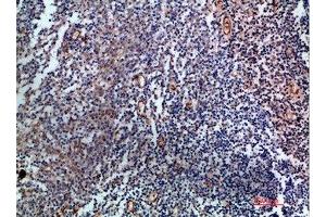 Immunohistochemical analysis of paraffin-embedded human-tonsil, antibody was diluted at 1:200 (Endoglin antibody  (AA 370-430))