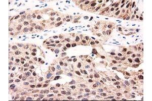 Image no. 8 for anti-UDP-Galactose-4-Epimerase (GALE) antibody (ABIN1498366)