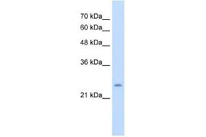 CHIC1 antibody used at 5 ug/ml to detect target protein. (CHIC1 antibody  (N-Term))
