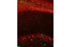 Immunohistochemistry (IHC) image for anti-Claudin 11 (CLDN11) (AA 188-207) antibody (ABIN1742489) (Claudin 11 antibody  (AA 188-207))