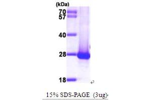 SDS-PAGE (SDS) image for DIRAS Family, GTP-Binding RAS-Like 1 (DIRAS1) (AA 1-195) protein (His tag) (ABIN667219) (DIRAS1 Protein (AA 1-195) (His tag))