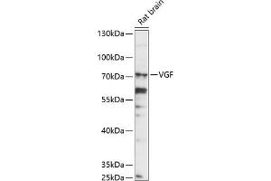 Western blot analysis of extracts of rat brain, using VGF antibody (ABIN7271321) at 1:1000 dilution. (VGF antibody  (AA 466-615))
