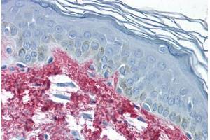 Human Skin (formalin-fixed, paraffin-embedded) stained with Collagen I antibody ABIN291823 at 2. (Collagen Type I antibody)