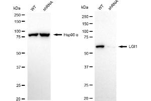 Western blotting analysis using LGI1 antibody (ABIN7799257).