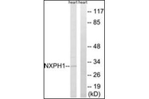 Western blot analysis of extracts from rat heart cells, using NXPH1 Antibody . (Neurexophilin 1 antibody  (C-Term))