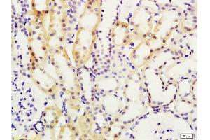 Formalin-fixed and paraffin embedded rat kidney tissue labeled with Anti-Smad7/Smad6 Polyclonal Antibody , Unconjugated at 1:200, followed by conjugation to the secondary antibody and DAB staining