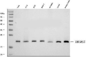 Western blot analysis of TMEM65 using anti-TMEM65 antibody (ABIN7603101).