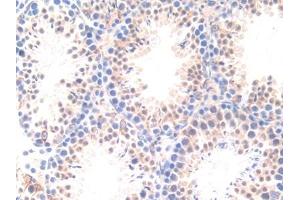 Detection of APOD in Mouse Testis Tissue using Polyclonal Antibody to Apolipoprotein D (APOD) (Apolipoprotein D antibody  (AA 1-189))