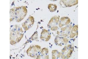 Immunohistochemistry of paraffin-embedded Human stomach using USH1C Polyclonal Antibody at dilution of 1:100 (40x lens). (USH1C antibody)