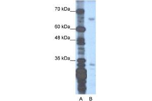 WB Suggested Anti-ZNF691 Antibody Titration:  1. (ZNF691 antibody  (N-Term))