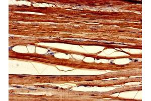 Immunohistochemistry of paraffin-embedded human skeletal muscle tissue using ABIN7147586 at dilution of 1:100