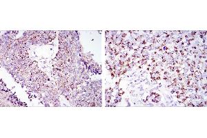 HSPD1 antibody