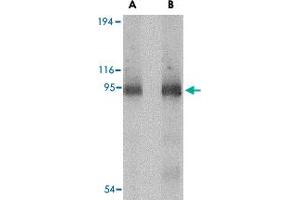 Western blot analysis of CD180 in human spleen tissue lysate with CD180 polyclonal antibody  at (A) 0. (CD180 antibody  (C-Term))