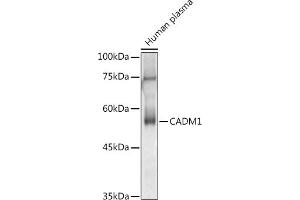 Western blot analysis of extracts of Human plasma, using C antibody (ABIN3022654, ABIN3022655, ABIN3022656 and ABIN6219028) at 1:1000 dilution. (CADM1 antibody  (AA 45-344))