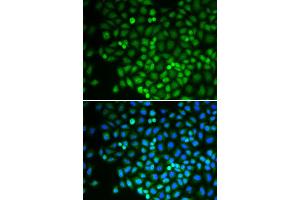 Immunofluorescence analysis of U2OS cell using POLR2D antibody. (POLR2D antibody)